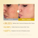 Kojic Acid Turmeric Toner