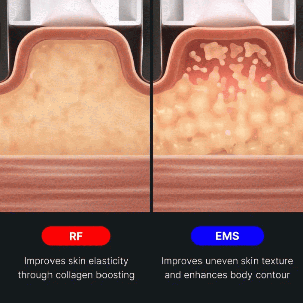 AGE-R Contour Body Shot